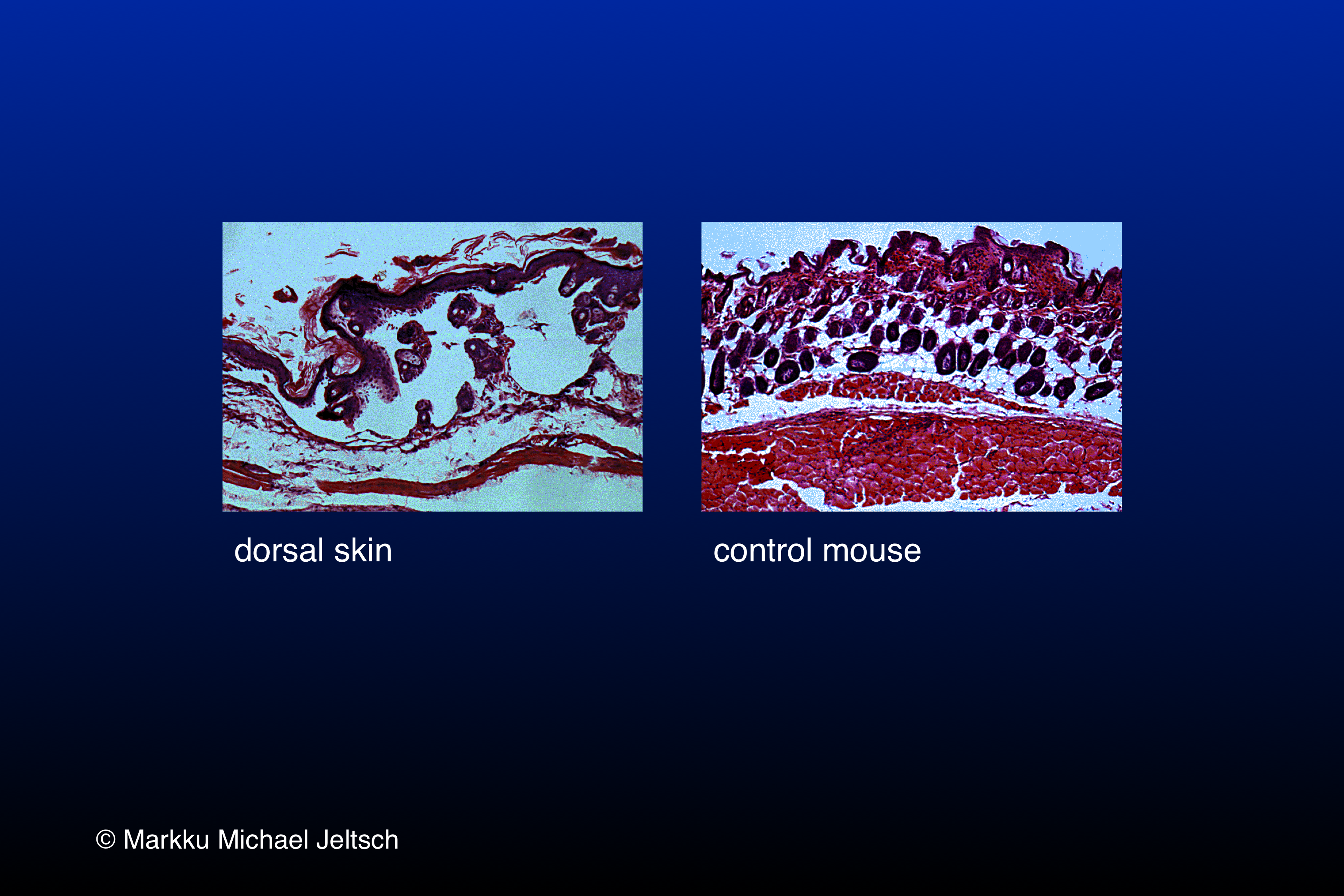 skin H&E staining of K14-VEGF-C transgenic mouse