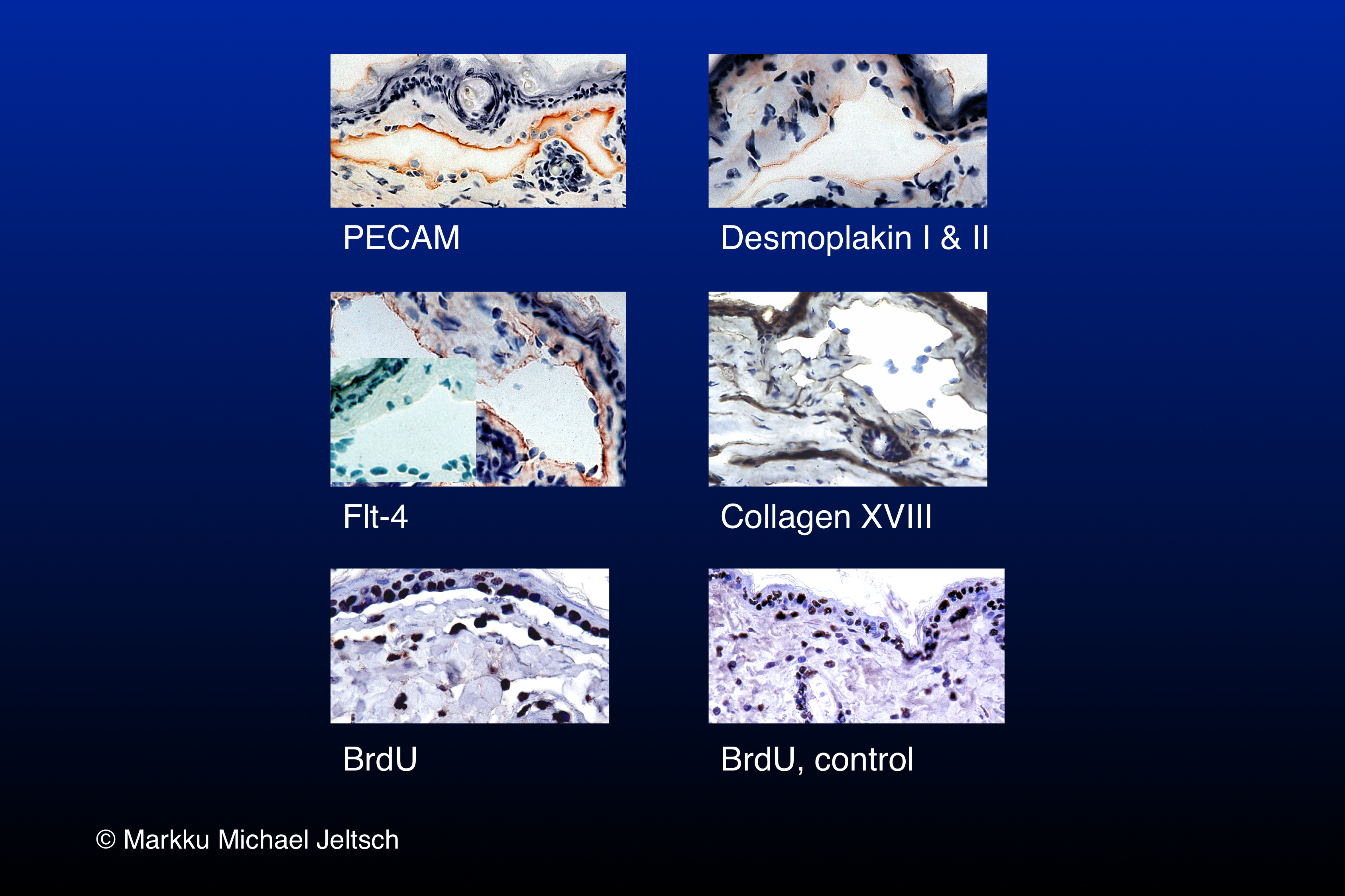 IHC of K14-VEGF-C transgenic mouse