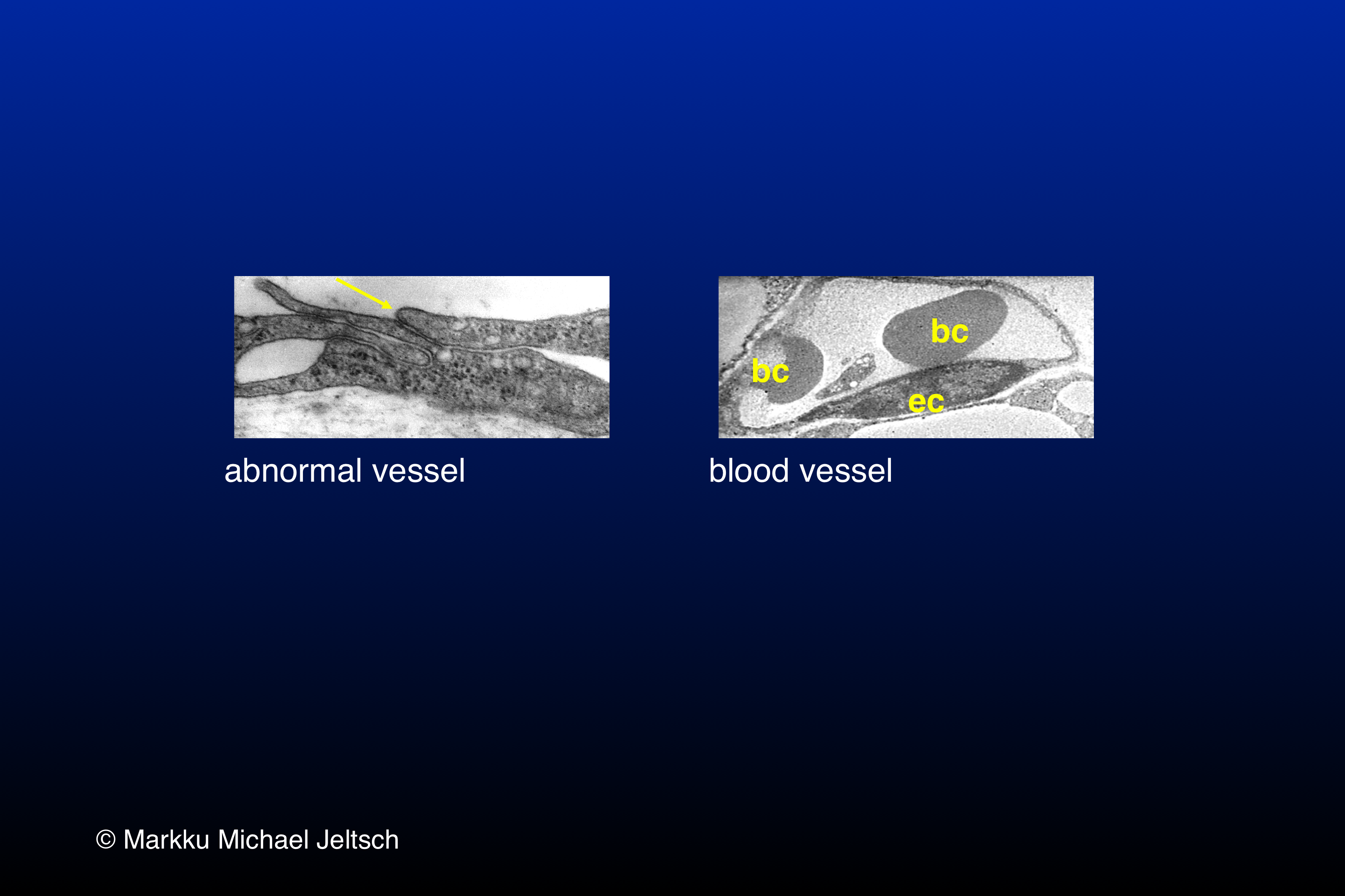 EM of K14-VEGF-C transgenic mouse