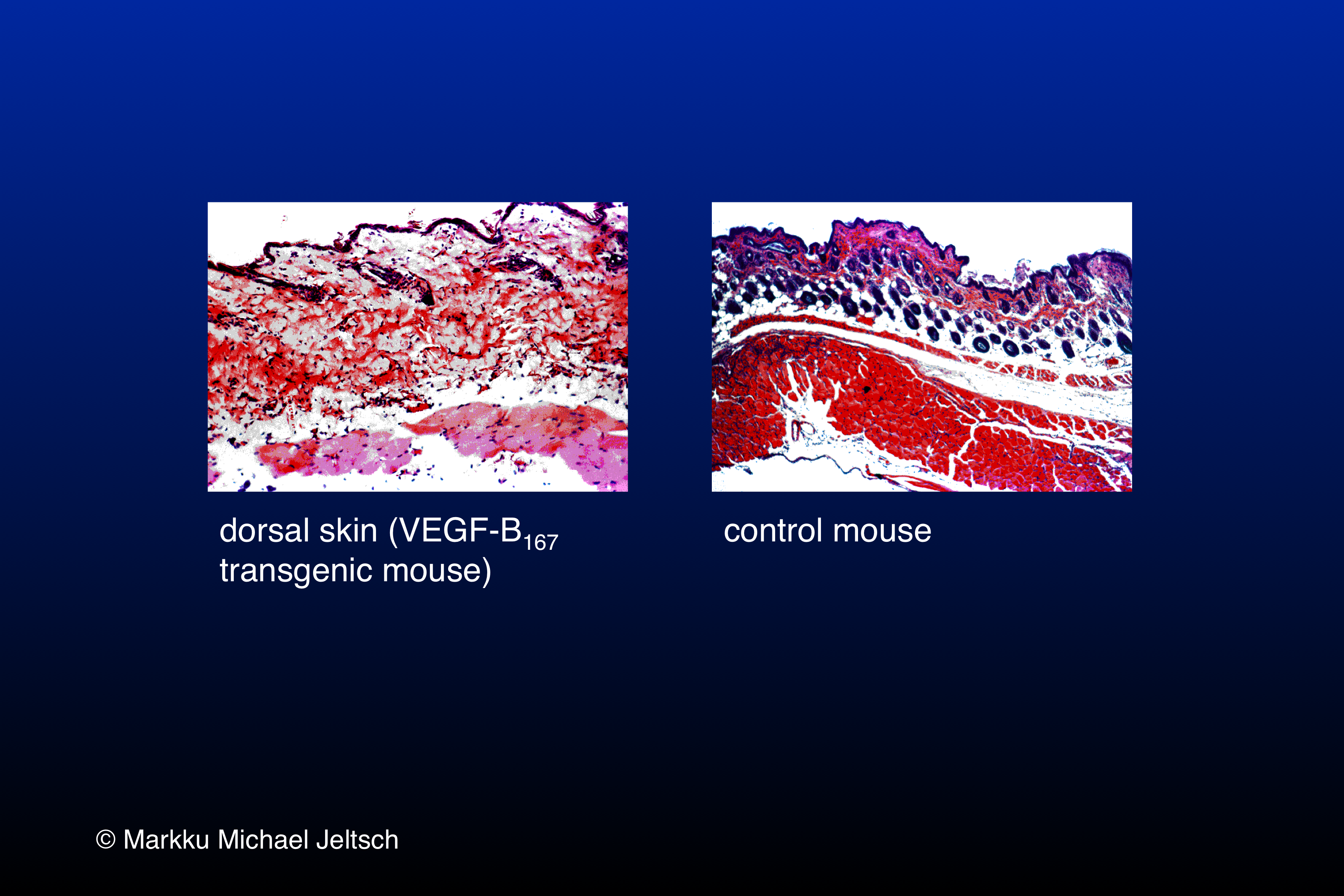 skin H&E staining of K14-VEGF-B167 transgenic mouse