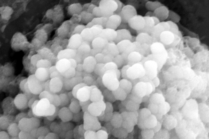 Scanning Electron Microscopy of VEGFC-loaded LNPs